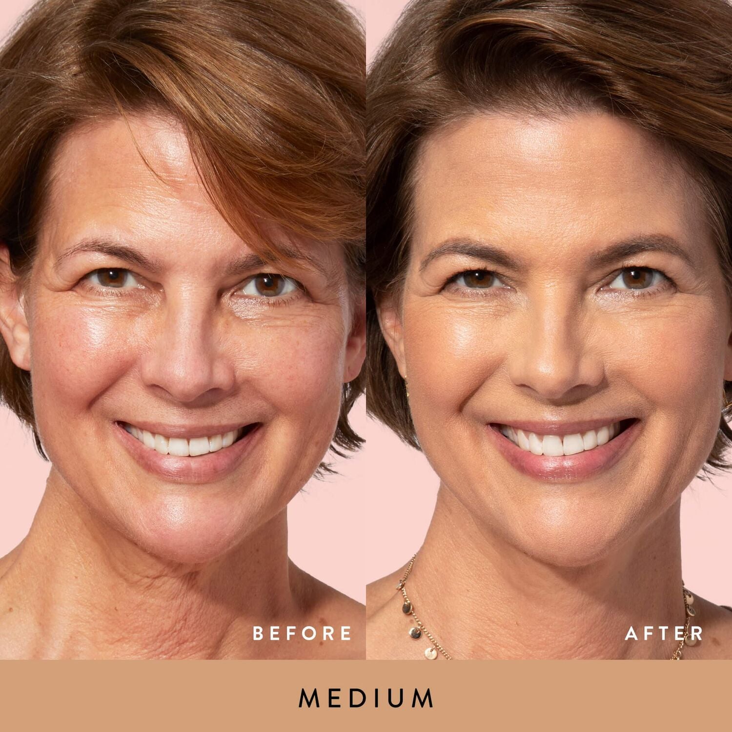 BalancenGlow-BeforeAfter_Medium-ECommerce_JPG_e7782556-9ff4-49e4-90dd-d83bd751527f
