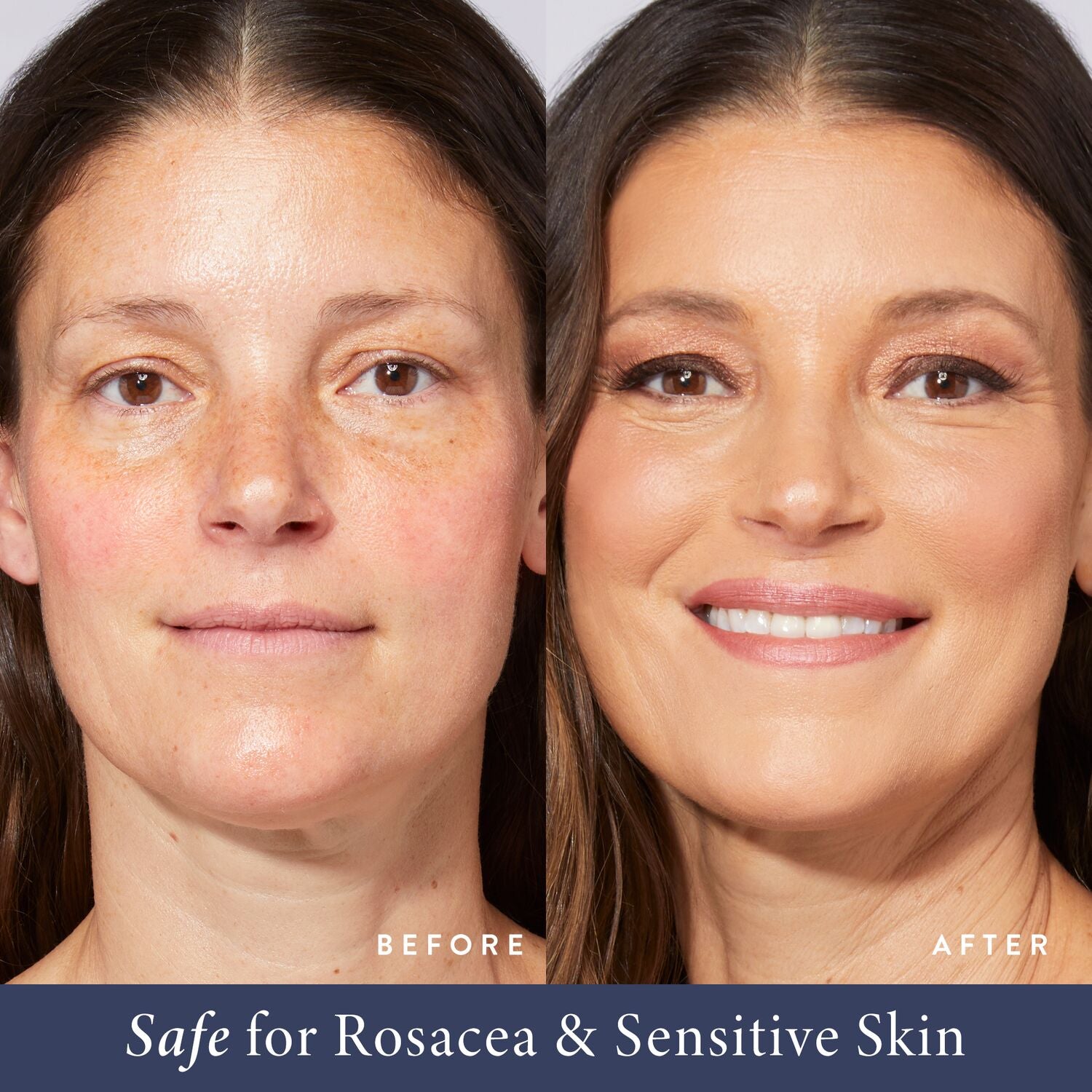 LG-BakedToGo-BalancenBrighten-BeforeAfter_RosaceaandSensitiveskin-ECommerce_JPG
