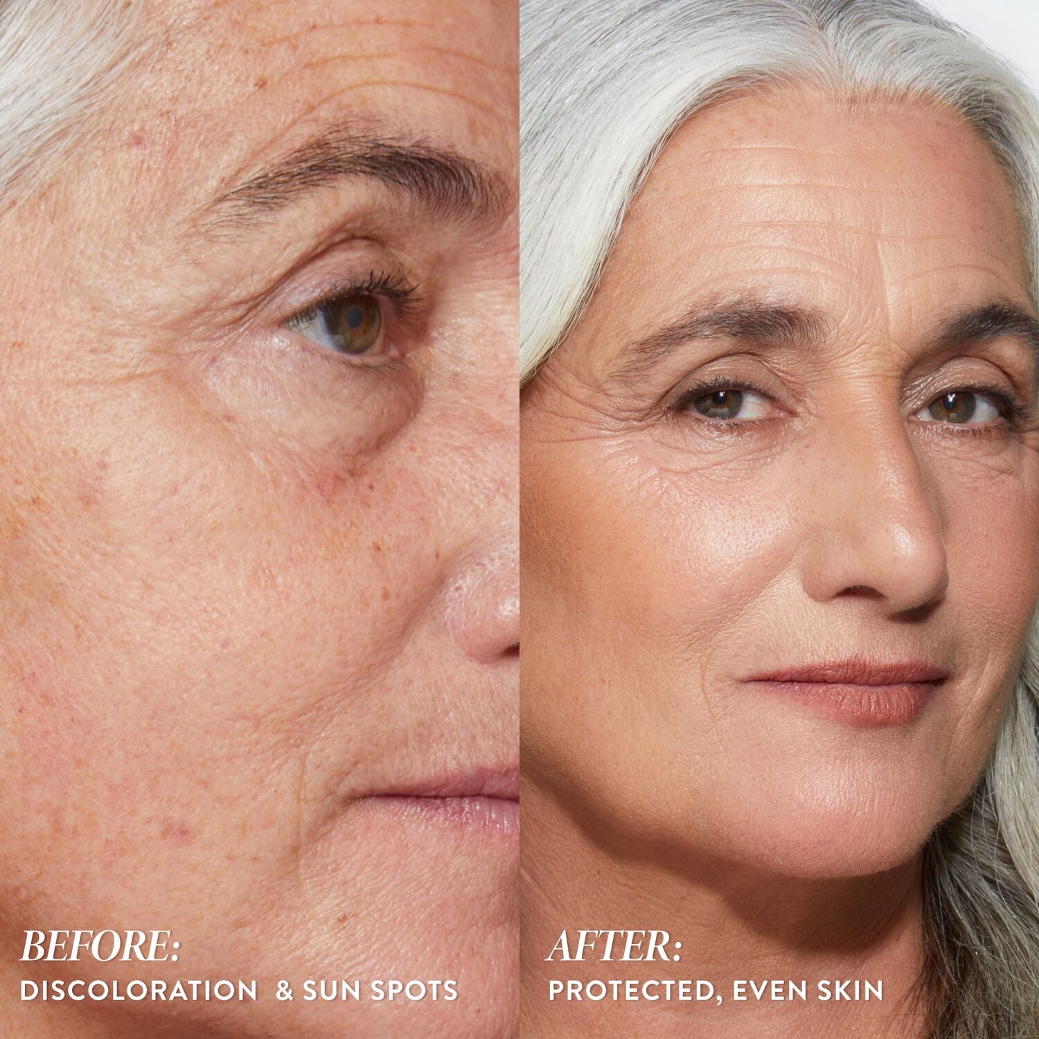 LG_BetterThanBlock_Before_After_SkinBenefits_Shona-ECommerce_JPG