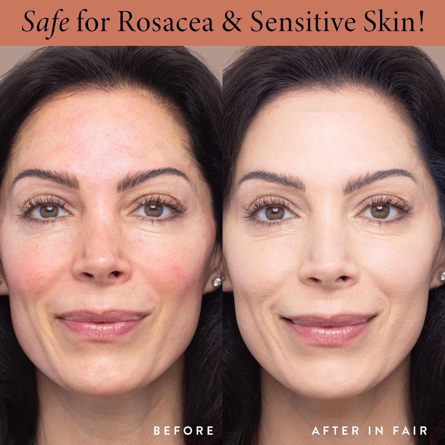 LauraGeller_DoubleTakeLiquidFoundation_BEforeandAfter_rosacea-ECommerce_JPG